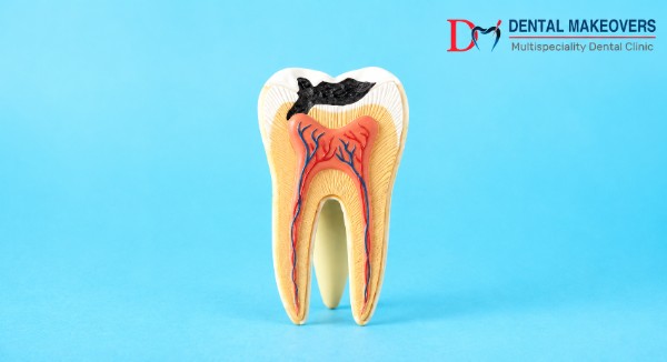 best dental clinic in Indore