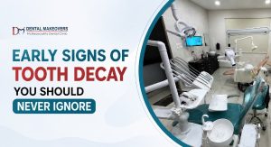 Early Signs of Tooth Decay You Should Never Ignore