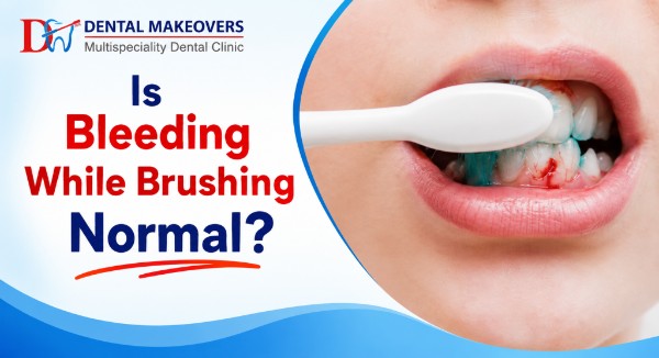 best dental clinic in Saket Indore