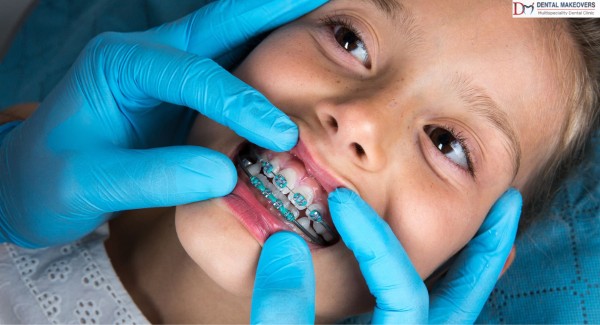 best dental clinic in Saket Indore