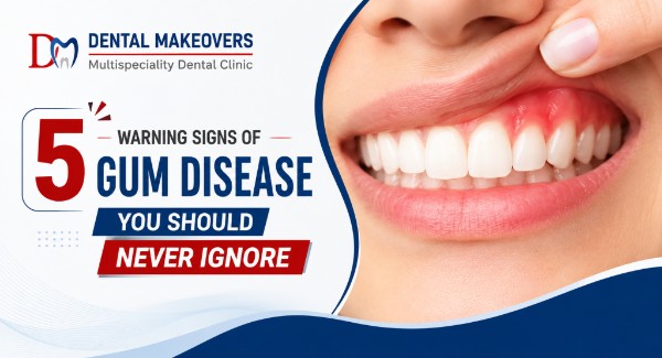 5 Warning Signs of Gum Disease You Should Never Ignore
