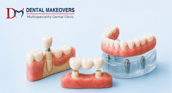 best dental clinic in Saket Indore