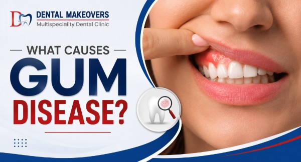 best dental clinic in Saket Indore