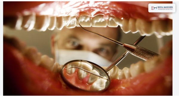 Best Dental Clinic in Indore