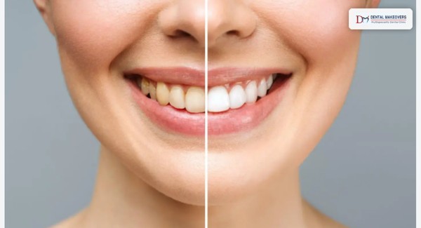 Best Dental Clinic in Indore