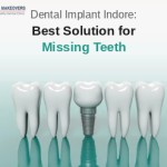 Dental Implant Indore: Best Solution for Missing Teeth