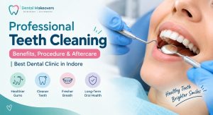 Professional Teeth Cleaning: Benefits, Procedure & Aftercare